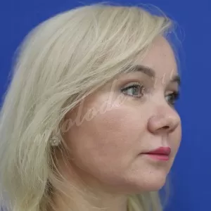 Комплекс_Гоглов