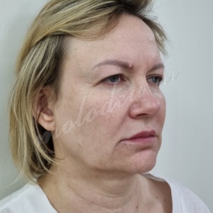 Комплекс_Колбасин