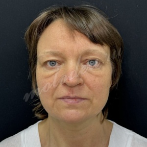 Круговая_Делецкий