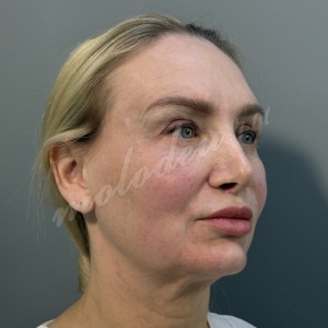 СМАС_Колбасин