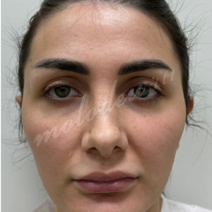 Комплекс_Гуляев