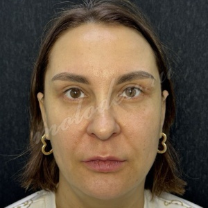 Комплекс_Делецкий