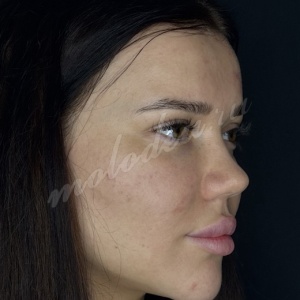 Рино_Карлов