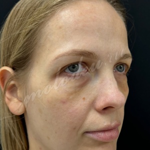 Комплекс_Гуляев