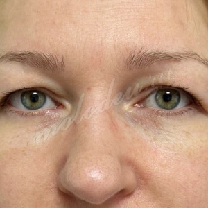 Верхняя_Гасымов