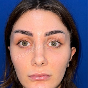 Комплекс_Гуляев