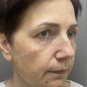 Агаев_комплекс