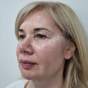 Лобно-височный_Колбасин