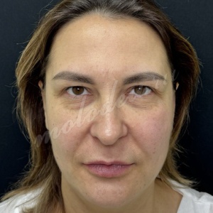 Комплекс_Делецкий