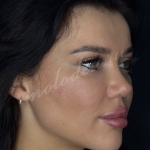 Рино_Карлов