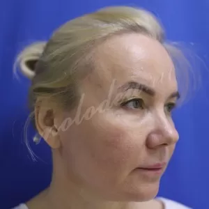 Комплекс_Гоглов