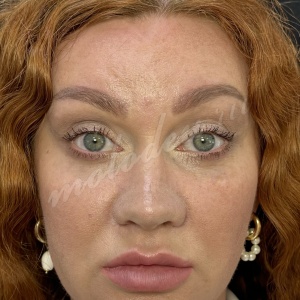 Комплекс_Делецкий