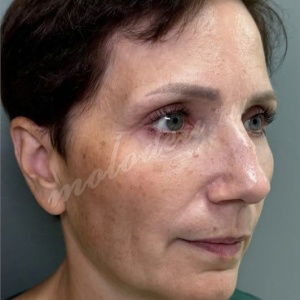 Агаев_комплекс