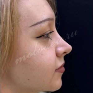 Рино_Агаеа