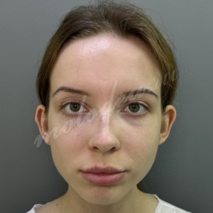 Ото_Делецкий