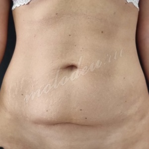 Абдомино_Колбасин