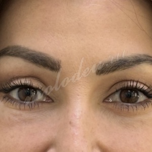 Мирзарахимов_блефаро