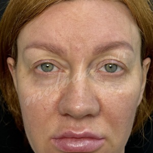 Комплекс_Делецкий