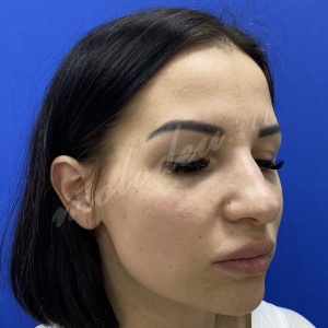 Риносепто_Колбасин