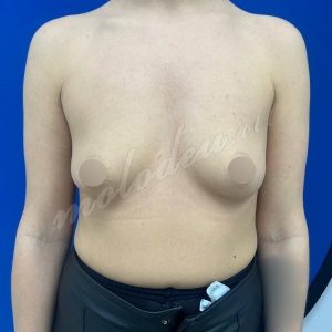 Маммо_Плотникова