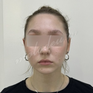 Отопластика _Делецкий